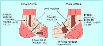 Regla De Otawa